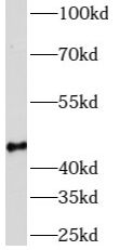      anti- AZI2 antibody