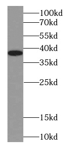 anti- B23 antibody