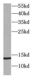      anti- B2M antibody