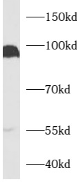 anti- AXIN2 antibody