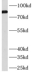      anti- ATRIP antibody