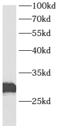      anti- AUH antibody