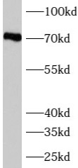      anti- AUTS2 antibody