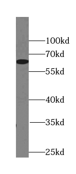 anti-BBS6 antibody