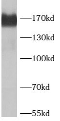 anti- BAF170 antibody