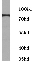      anti- BAG3 antibody