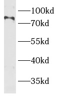      anti- BBS10 antibody