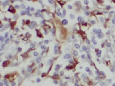      anti- BAGE4 antibody