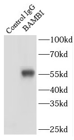 BAMBI抗体