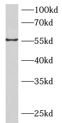      anti- BAMBI antibody