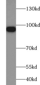      anti- band 3 antibody