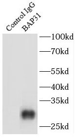      anti- BAP31 antibody