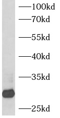      anti- BAP31 antibody