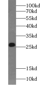      anti- BAK antibody