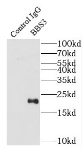 anti- BBS3 antibody