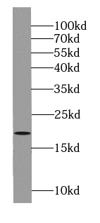 anti- BBS3 antibody