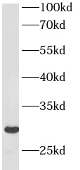      anti- BAP29 antibody