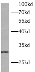      anti- ATP6V1E2 antibody