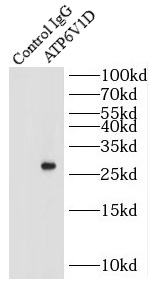      anti- ATP6V1D antibody