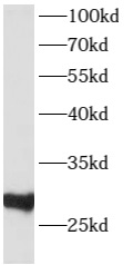      anti- ATP6V1D antibody