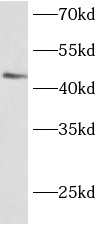 anti- BARHL2 antibody