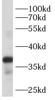 anti- B4GALT7 antibody