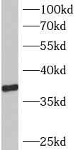      anti- B3GALT6 antibody