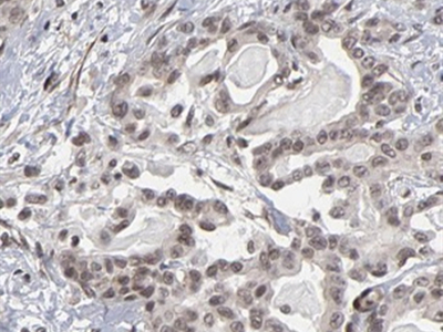      anti- B3GALT4 antibody