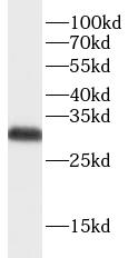      anti- ATP6V1E1 antibody