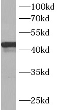      anti- B3GALNT1 antibody