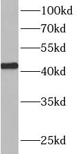 anti- ATXN3L antibody