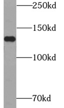 anti- ATXN2L antibody 