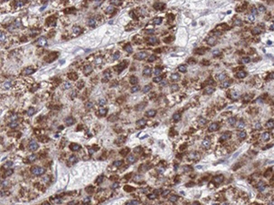      anti- B4GALT3 antibody