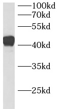      anti- B3GNT3 antibody