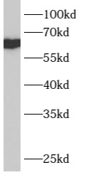      anti- B4GALNT1 antibody