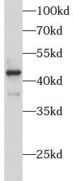 anti- ATP6V1C1 antibody