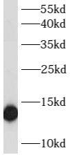      anti- ATP6V1G2 antibody