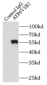 anti- ATP6V1B2 antibody