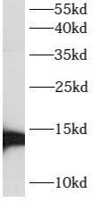      anti- ATP6V1G3 antibody