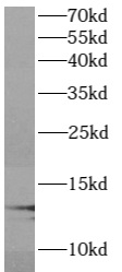      anti- ATP6V1G1 antibody