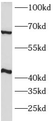      anti- ATP1B2 antibody