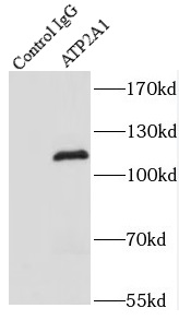      anti- ATP2A1 antibody