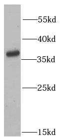 anti- ATG3 antibody