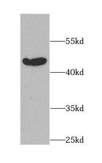      anti- BAG1 antibody