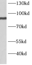 anti- BARD1 antibody