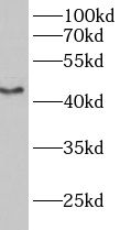      anti- B3GALT2 antibody