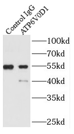      anti- ATP6V0D1 antibody