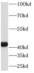      anti- ATP6V0D1 antibody