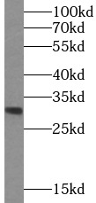      anti- ASRGL1 antibody