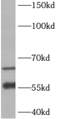      anti- B3GALNT2 antibody